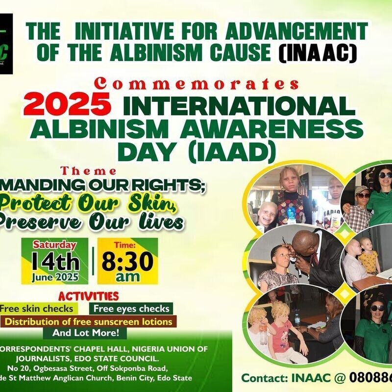 International Albinism Awareness Day Event