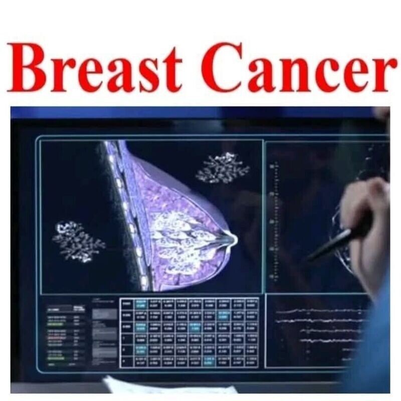 BREAST CANCER LECTURES