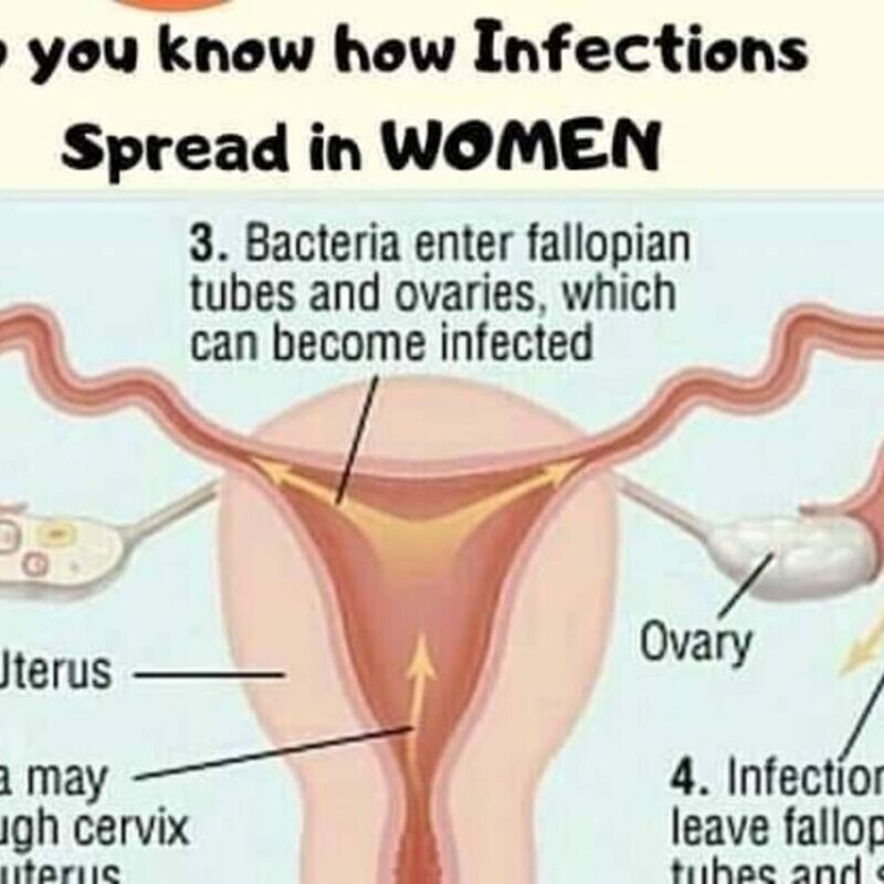 Lecture on the Treatment of Acute Ulcer